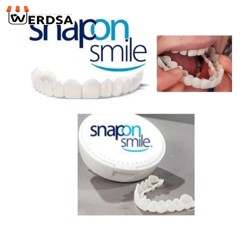 لمینت متحرک دندان تک فک snap on smile