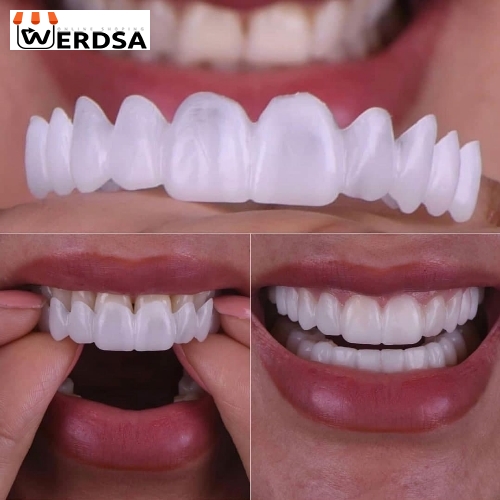 لمینت متحرک دندان تک فک snap on smile کد 1496 شرکتی اصلی