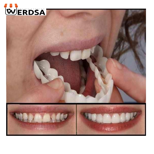 لمینت متحرک دندان تک فک snap on smile کد 1496 شرکتی اصلی